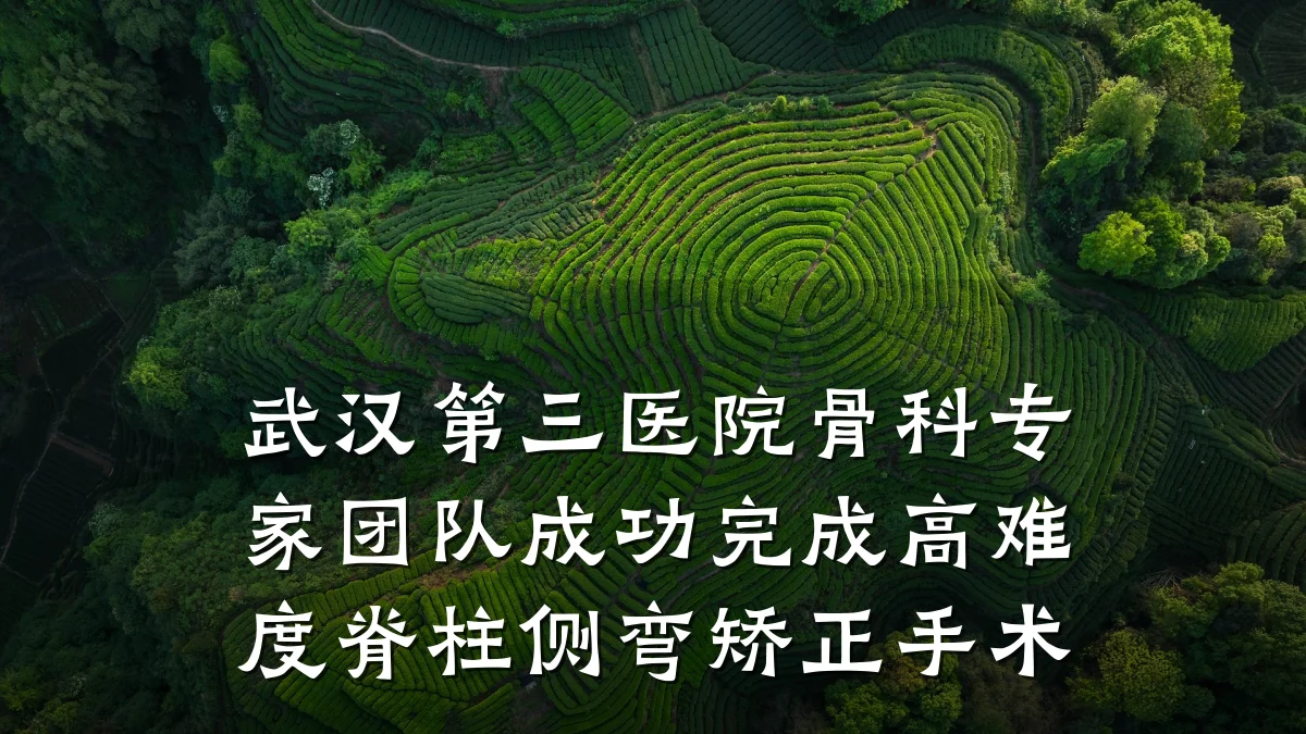 武汉第三医院骨科专家团队成功完成高难度脊柱侧弯矫正手术