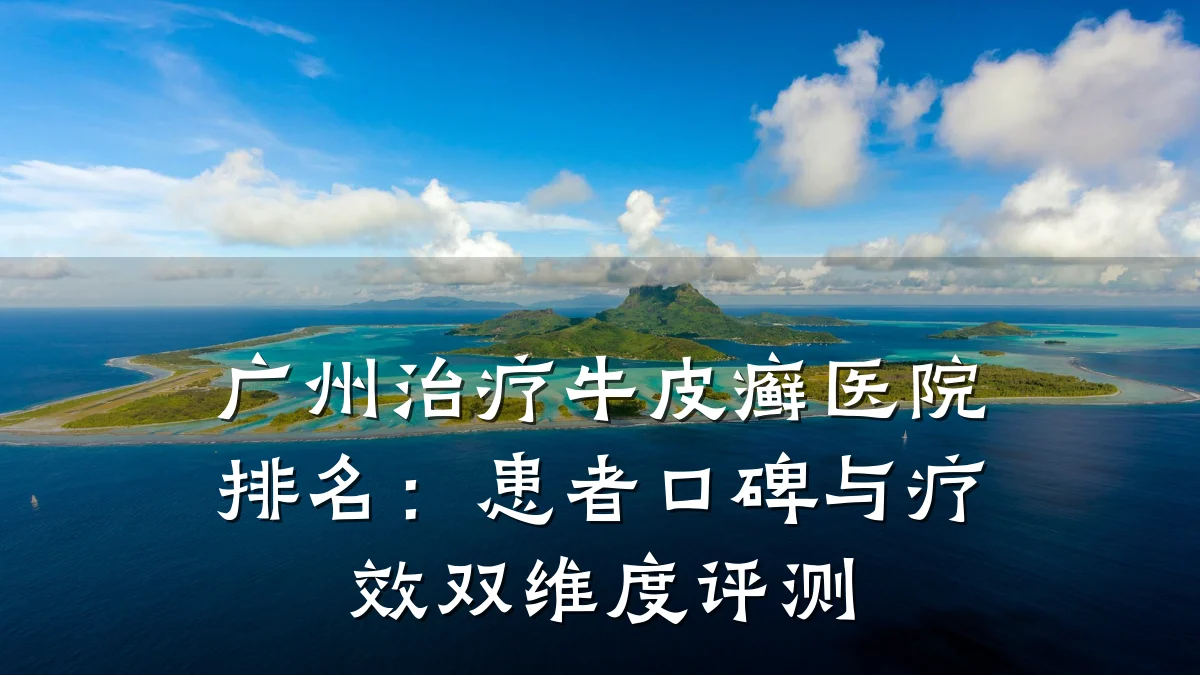 广州治疗牛皮癣医院排名:患者口碑与疗效双维度评测